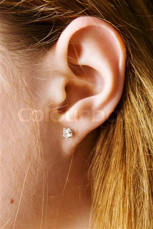 Asian Otoplasty - female ear pinback surgery
